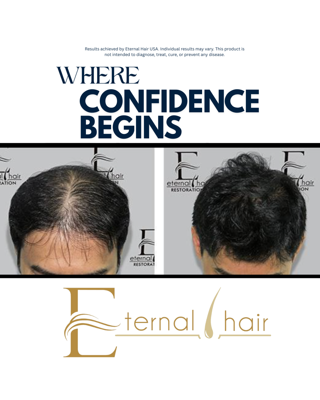 Eternal Hair™ – Men’s Hair Support Supplement