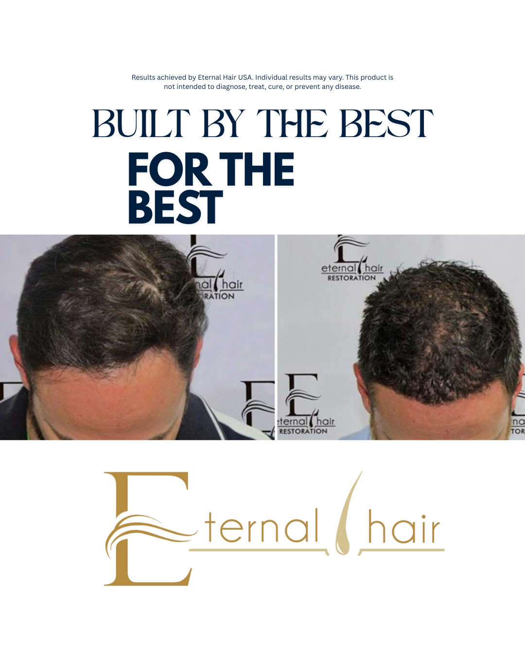 Eternal Hair™ – Men’s Hair Support Supplement